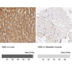 CBS Antibody, Novus Biologicals 25 &mu;L; Unlabeled:Antibodies, Polyclonal